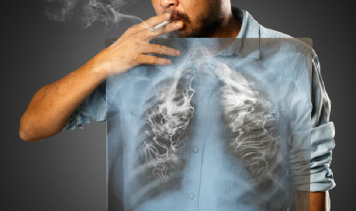 Thuốc lá đang giết chế lá phổi của chúng ta