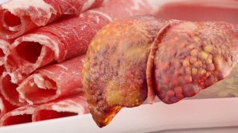 Bệnh xơ gan có ăn được thịt bò không? Chuyên gia giải đáp