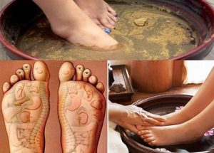 Top 3 cách trị đau gót chân bằng thuốc nam hay và hiệu quả