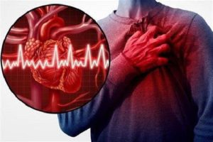 Dấu hiệu cao huyết áp ở người trẻ 